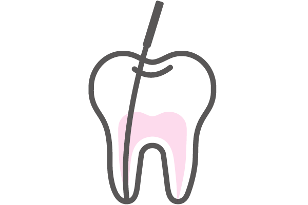 ROOT CANAL TREATMENT